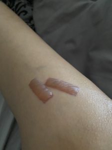 Laser burn injuries caused by negligence.